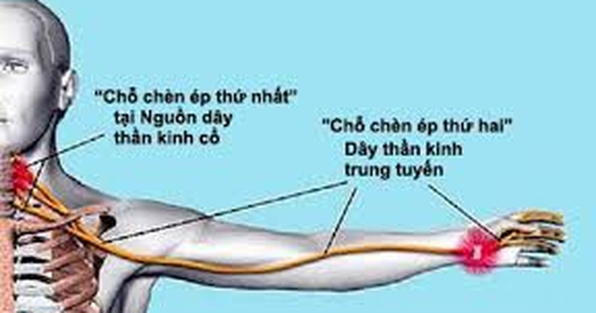 4. Phương pháp điều trị và phục hồi