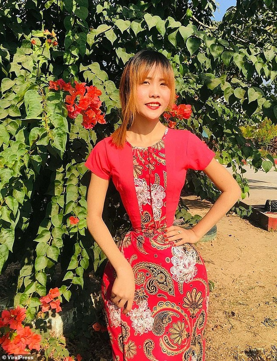 Cô gái Myanmar sở hữu “vòng eo con kiến” 35 cm - 6 Cô gái Myanmar sở hữu “vòng eo con kiến” 35 cm - 6