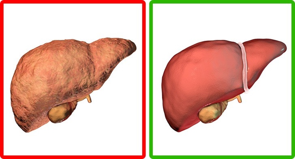 Điều gì sẽ xảy ra với cơ thể nếu uống loại sữa này trước khi đi ngủ - 1 Điều gì sẽ xảy ra với cơ thể nếu uống loại sữa này trước khi đi ngủ - 1