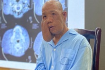 Khối u lớn ở má khiến người đàn ông bị biến dạng cả mặt