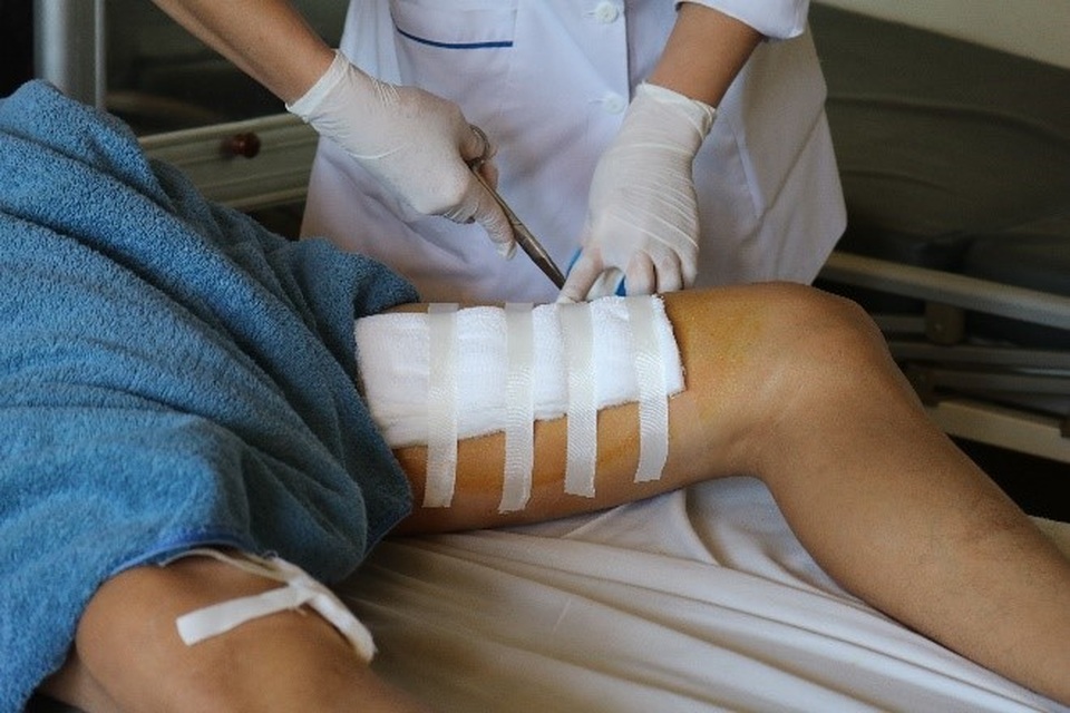 Dùng đùi giữ bình rượu ổi để mở nắp, người đàn ông nhập viện cấp cứu - 2 Dùng đùi giữ bình rượu ổi để mở nắp, người đàn ông nhập viện cấp cứu - 2