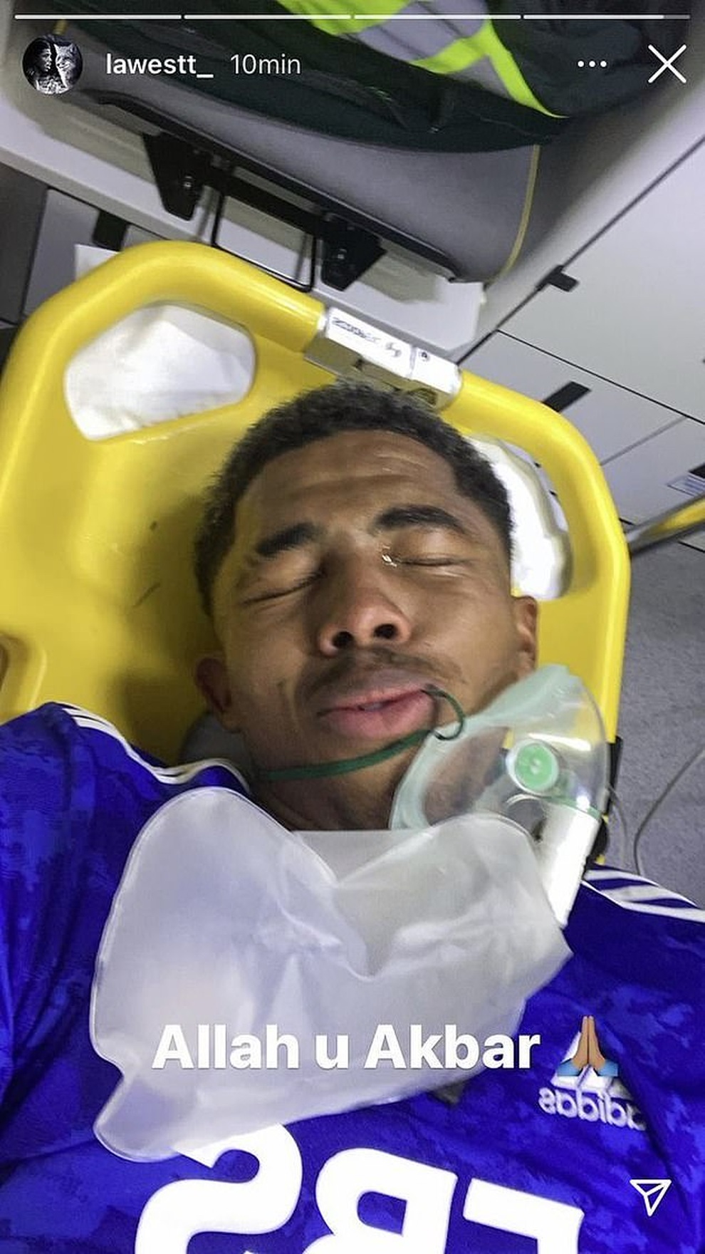 Ngôi sao trẻ Leicester gãy chân kinh hoàng khi đối thủ vào bóng thô bạo - 5 Ngôi sao trẻ Leicester gãy chân kinh hoàng khi đối thủ vào bóng thô bạo - 5