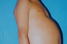 Xin cứu lấy cháu Tuấn!