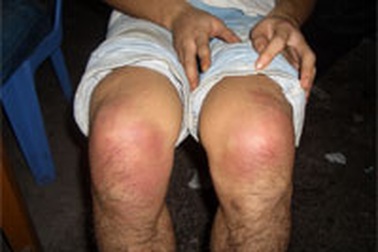 Vì sao lại có bản “tố cáo sai sự thật”?