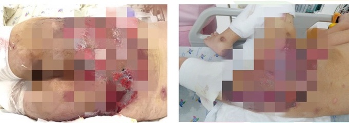 Bé 8 tuổi hồi phục ngoạn mục sau tai nạn giao thông - Ảnh 1. Bé 8 tuổi hồi phục ngoạn mục sau tai nạn giao thông - Ảnh 1.