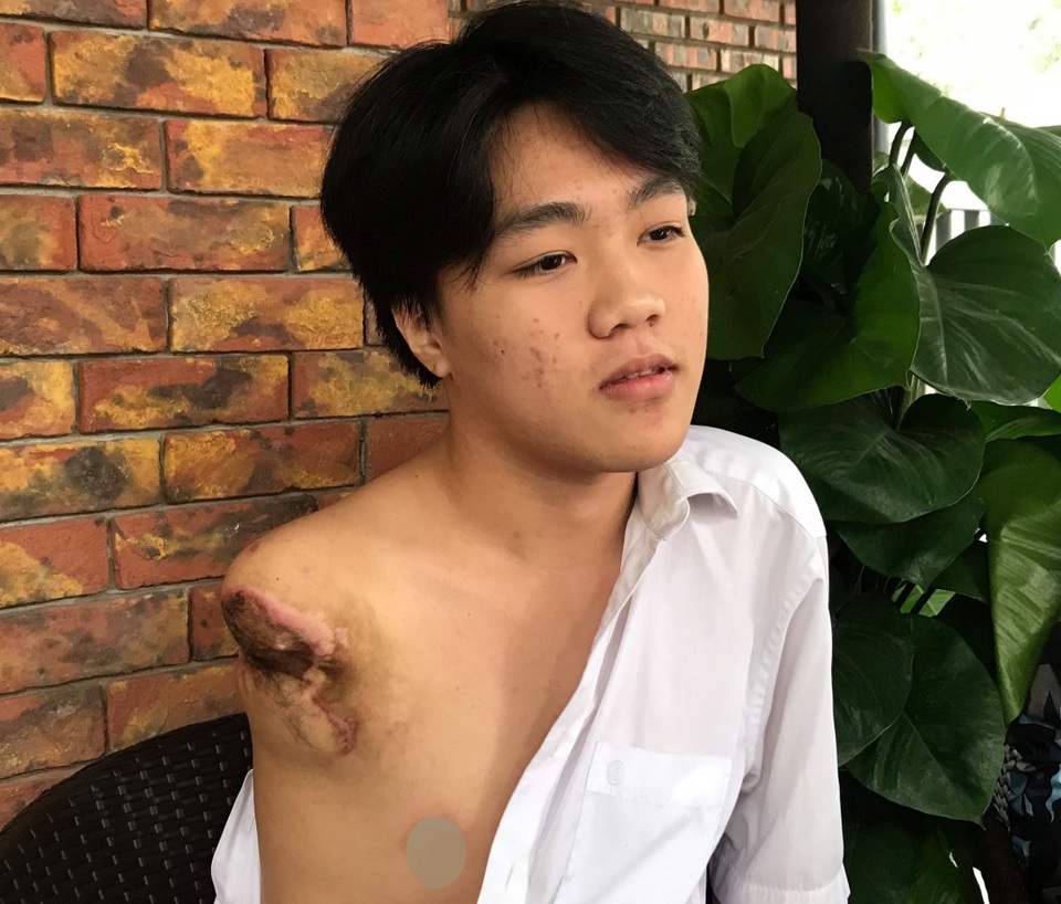 Nam sinh bị máy tiện quấn đứt cánh tay, gia đình bức xúc đòi hỗ trợ! - 3 Nam sinh bị máy tiện quấn đứt cánh tay, gia đình bức xúc đòi hỗ trợ! - 3