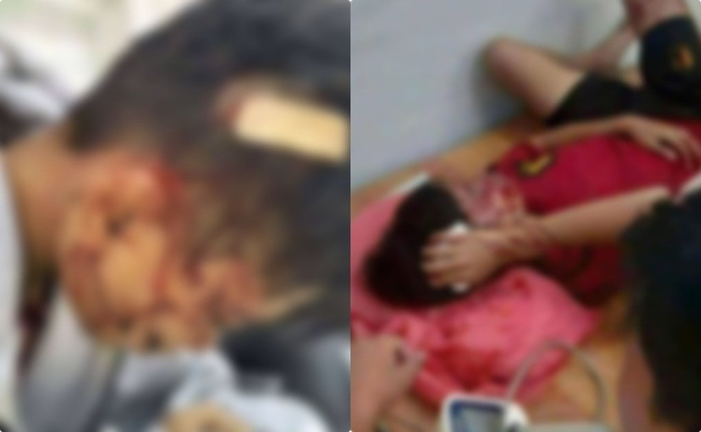 Serie von Schülerkämpfen, die zu Krankenhausaufenthalten führten, Schulleiter muss Verantwortung übernehmen - 2 Loạt vụ học sinh đánh nhau nhập viện, hiệu trưởng phải chịu trách nhiệm - 2