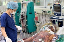 Liên tiếp trường hợp nguy kịch, phải cắt ngón vì bệnh từ lợn