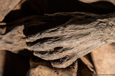 Khám phá mới có thể viết lại lịch sử bệnh đậu mùa