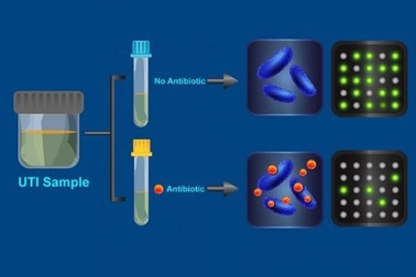 Xét nghiệm tìm ra vi khuẩn kháng kháng sinh trong 30 phút