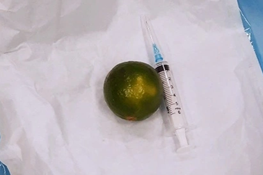 Nuốt quả chanh mắc kẹt ở cổ họng, chàng trai 27 tuổi ngưng thở nguy kịch