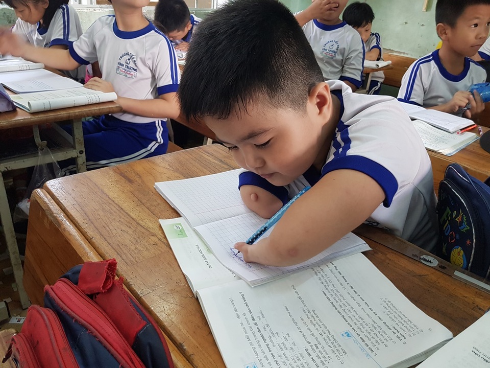 Nghị lực của cậu bé viết chữ bằng 3 ngón tay của bàn tay trái - 3 Nghị lực của cậu bé viết chữ bằng 3 ngón tay của bàn tay trái - 3