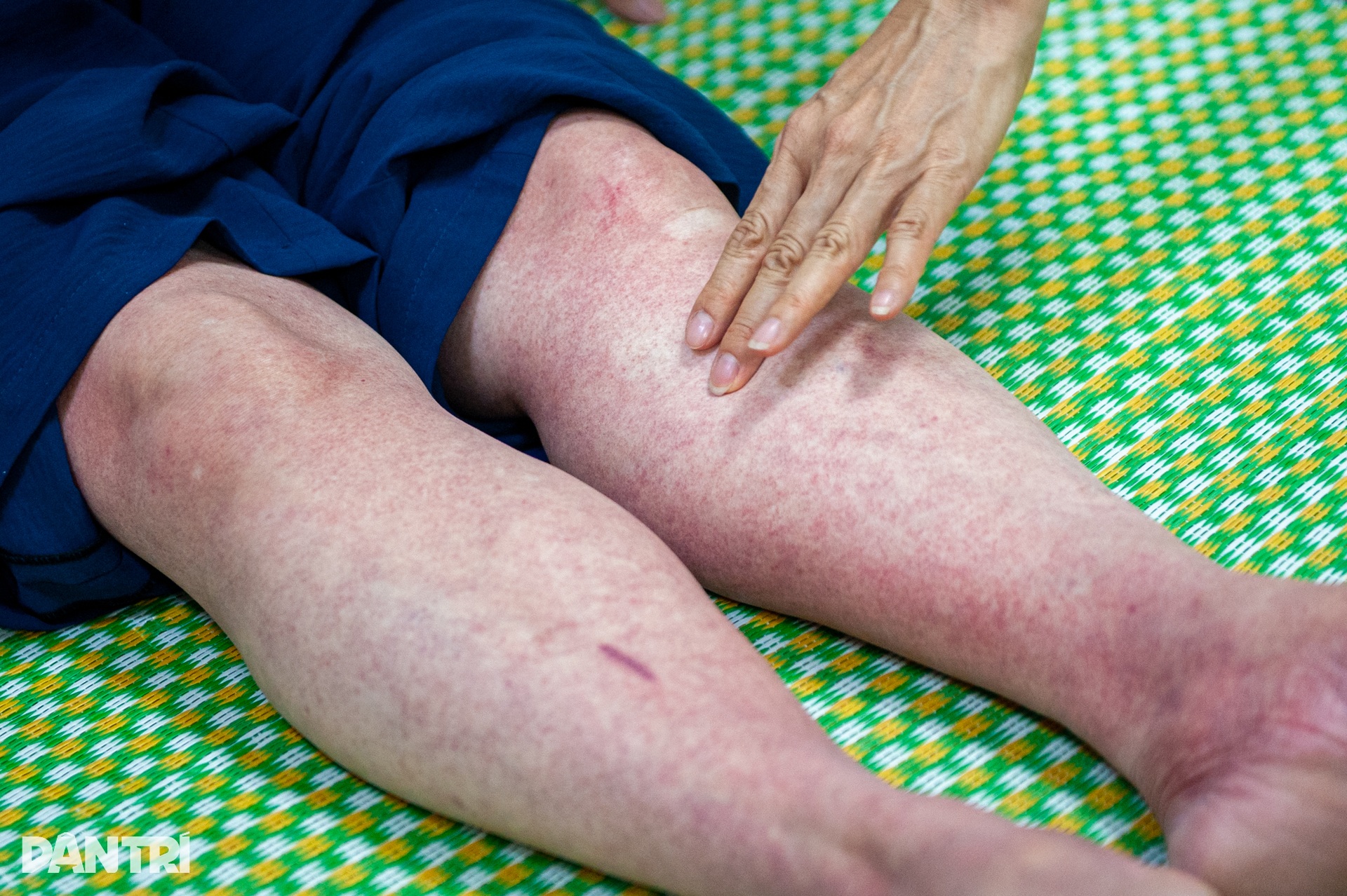 Hà Nội: Dịch bất thường, bệnh nhân ám ảnh vì cô đặc máu - 8 Hà Nội: Dịch bất thường, bệnh nhân ám ảnh vì cô đặc máu - 8