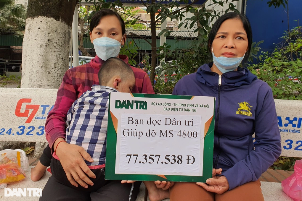 Cậu bé bị biến dạng khuôn mặt vì ngã vào chậu nước nóng đã được tới viện - 2 Cậu bé bị biến dạng khuôn mặt vì ngã vào chậu nước nóng đã được tới viện - 2