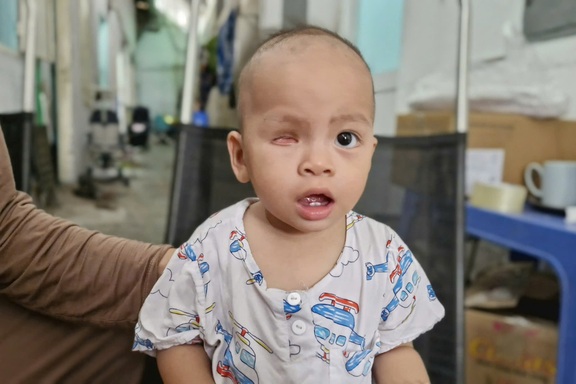 Mẹ nghèo cầu xin cứu con mắt còn lại của bé trai 2 tuổi