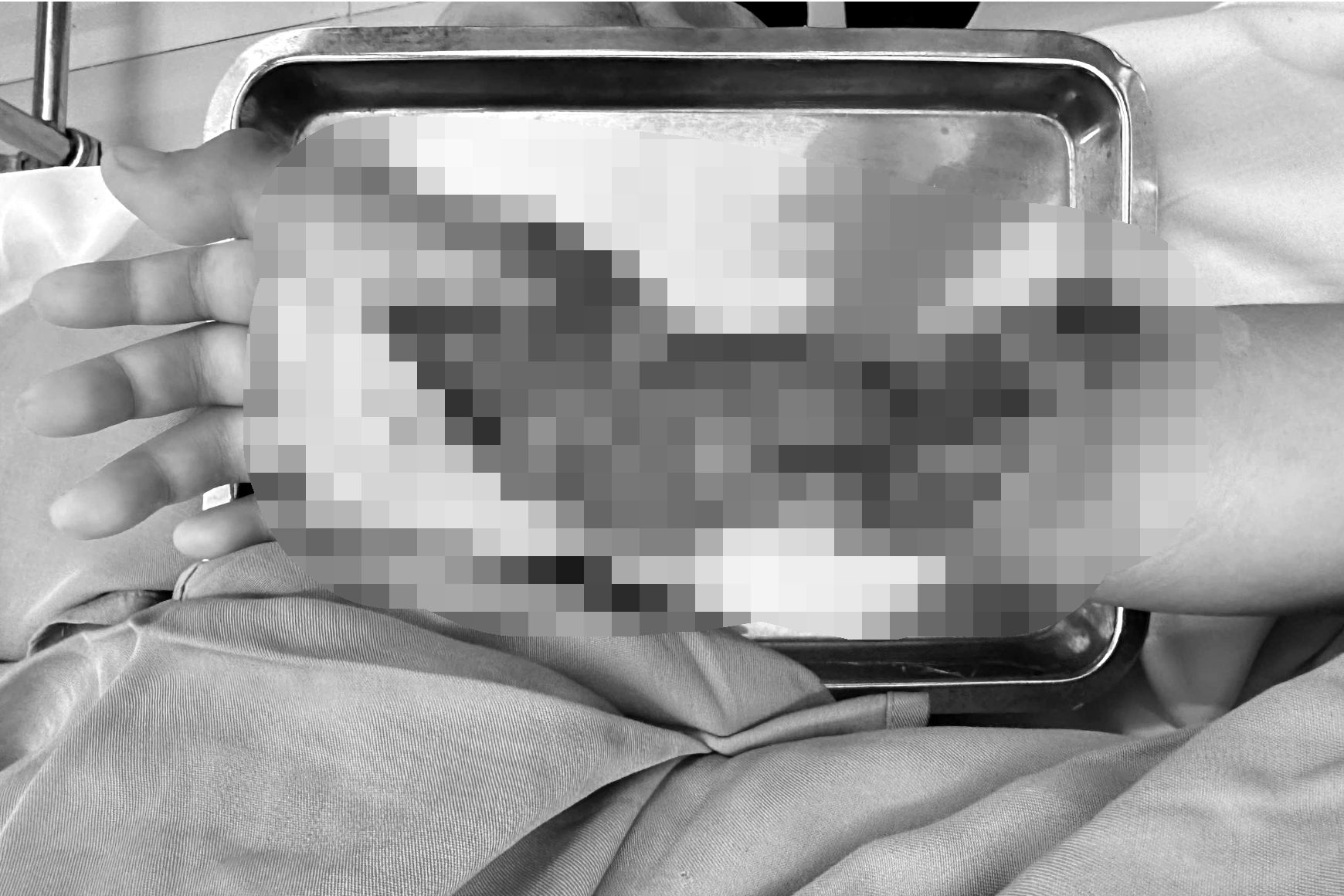 Tường gạch bất ngờ đổ sập, cháu bé 10 tuổi gặp chấn thương nghiêm trọng - 1
