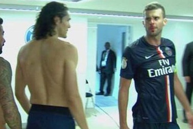 Sao PSG bị đối thủ đấm vỡ mũi