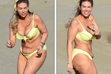 Giảm cân sốc, Frankie Essex lộ da nhăn nheo