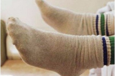 Máy bay phải hạ cánh khẩn cấp vì “mùi lạ như mùi tất thối”