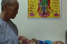 Mắc bệnh lạ, cô gái giảm gần 40kg trong vòng ít tháng