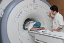 Ai cần chụp cắt lớp vi tính ngực liều thấp để phát hiện ung thư?