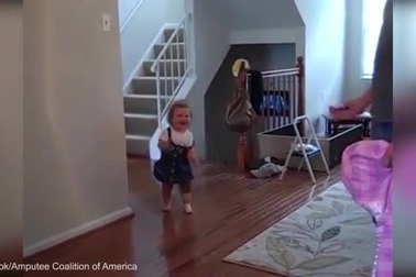 Cảm động giây phút bé bước đi lần đầu trên chân giả