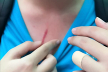 Bộ Giáo dục chỉ đạo xử lý vụ bạo lực học đường tại trường quốc tế ở TPHCM