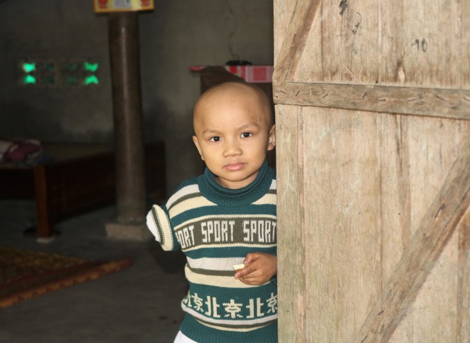 Lời cầu xin của bé trai 5 tuổi bị ung thư xương bên người anh bại não “Con chỉ còn một tay thôi, mẹ xin bác sĩ đừng cắt của con đi - Ảnh 1. Lời cầu xin của bé trai 5 tuổi bị ung thư xương bên người anh bại não “Con chỉ còn một tay thôi, mẹ xin bác sĩ đừng cắt của con đi - Ảnh 1.