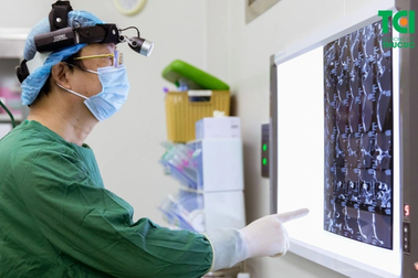 Hơn 2 giờ phẫu thuật cứu đôi tai bị thủng màng nhĩ do viêm tai giữa