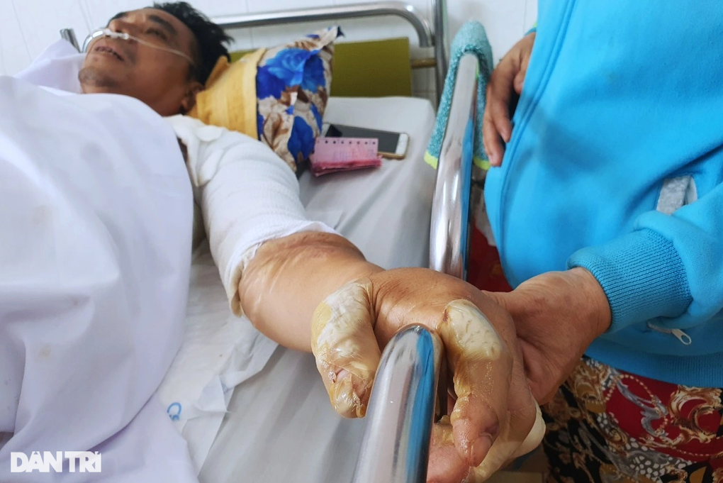 Người đàn ông hóa thành ngọn đuốc sống trào nước mắt bên giường bệnh - 3 Người đàn ông hóa thành ngọn đuốc sống trào nước mắt bên giường bệnh - 3