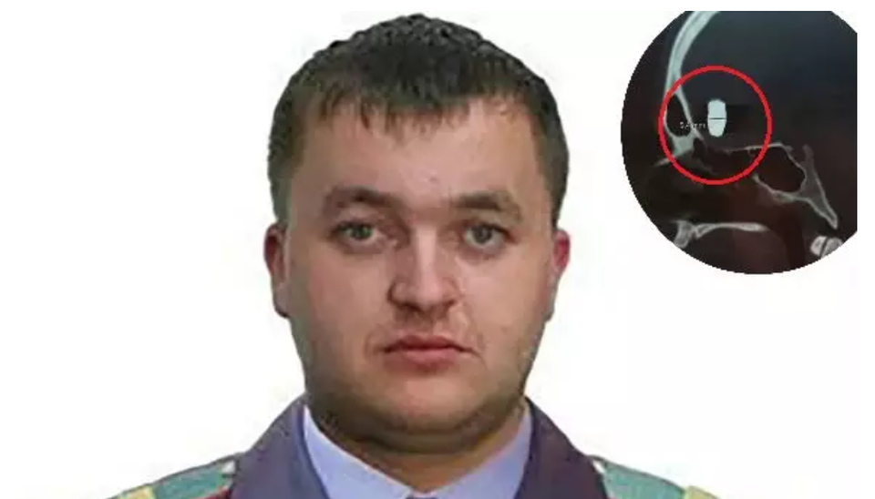 Ăn mừng 10 năm sống bình thường với một viên đạn trong não - 1 Ăn mừng 10 năm sống bình thường với một viên đạn trong não - 1