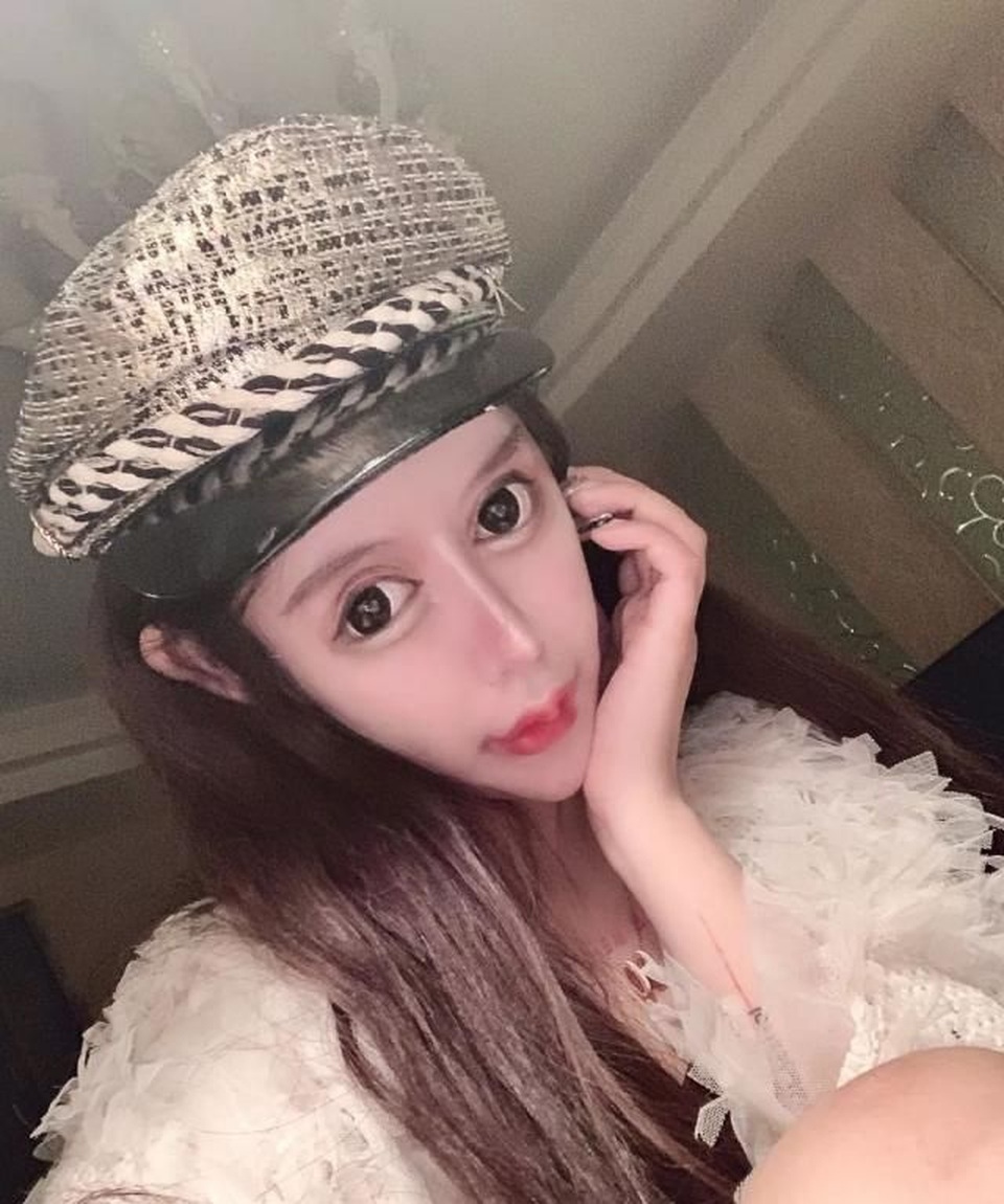 Hoảng sợ trước “gương mặt rắn” của người mẫu 16 tuổi nghiện phẫu thuật - 6 Hoảng sợ trước “gương mặt rắn” của người mẫu 16 tuổi nghiện phẫu thuật - 6