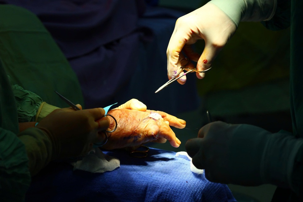 Những ca mổ “0 đồng” giúp hàng trăm người tìm lại hình hài sau biến cố - 12