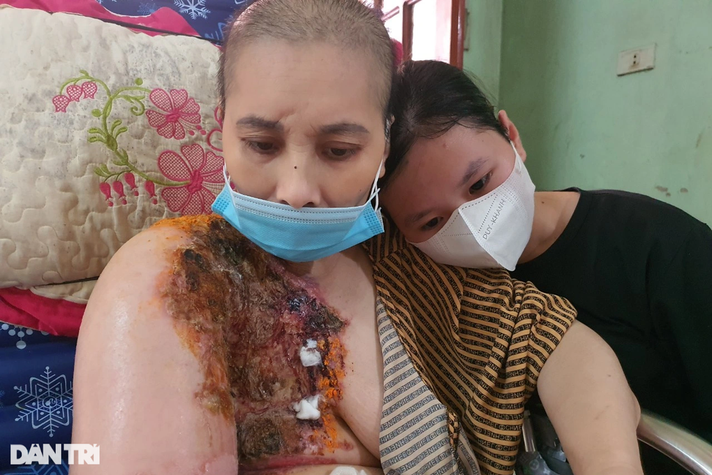 Người mẹ ung thư nghẹn ngào em không còn nước mắt để khóc - 7 Người mẹ ung thư nghẹn ngào em không còn nước mắt để khóc - 7