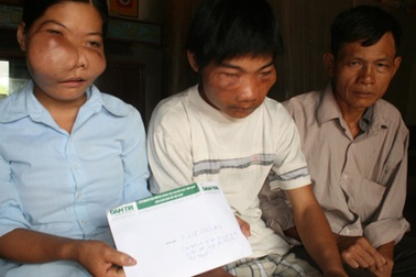 Cận cảnh gia đình có 5 số phận đáng thương