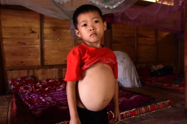 Mong manh sự sống của cậu bé 6 tuổi mắc bệnh hiểm nghèo