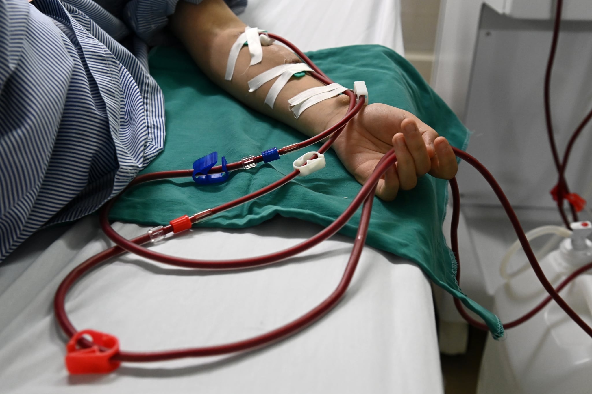 13 năm sống mòn vì chạy thận của cô gái 22 tuổi - 1
