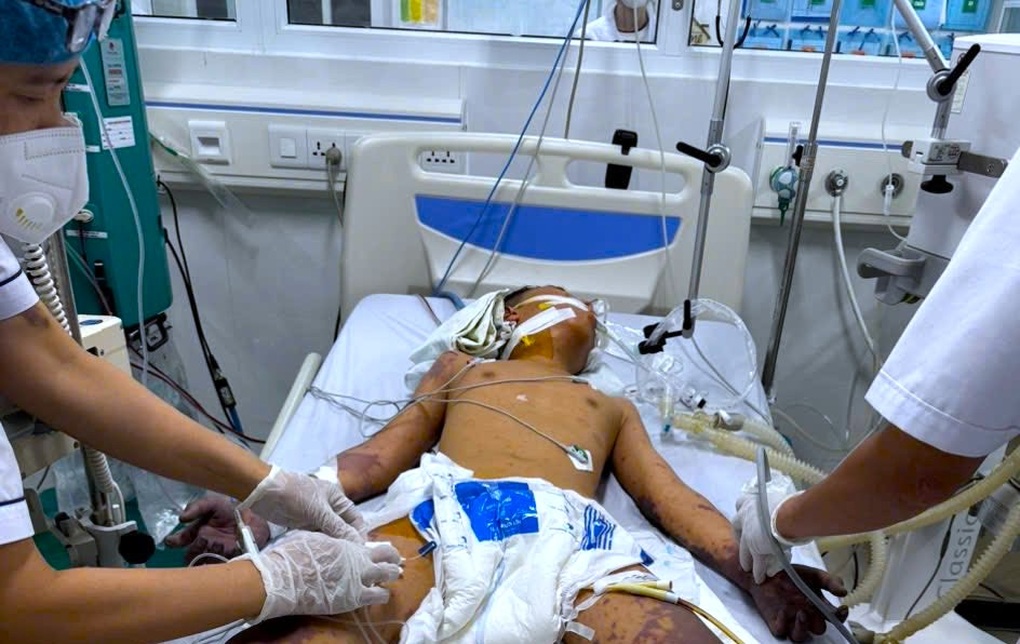 Cầu thủ bóng đá phải cắt bỏ chân vì mắc bệnh do não mô cầu - 3