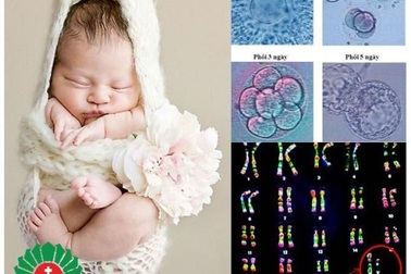 Miễn phí khám vô sinh BS Thái Lan