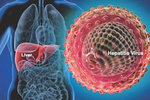 Những ai cần dè chừng bệnh ung thư gan