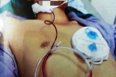 Bị can ngăn, Đường “Nhuệ” đánh nam thanh niên gãy xương hàm dưới