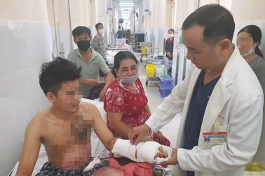 Bác sĩ vượt "bão" đấu thầu, đem máy tiền tỷ về cứu bệnh nhân bỏng nặng