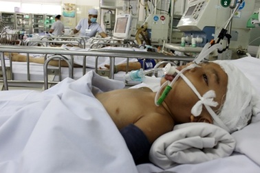 Trượt chân cầu thang, bé 3 tuổi hôn mê sâu