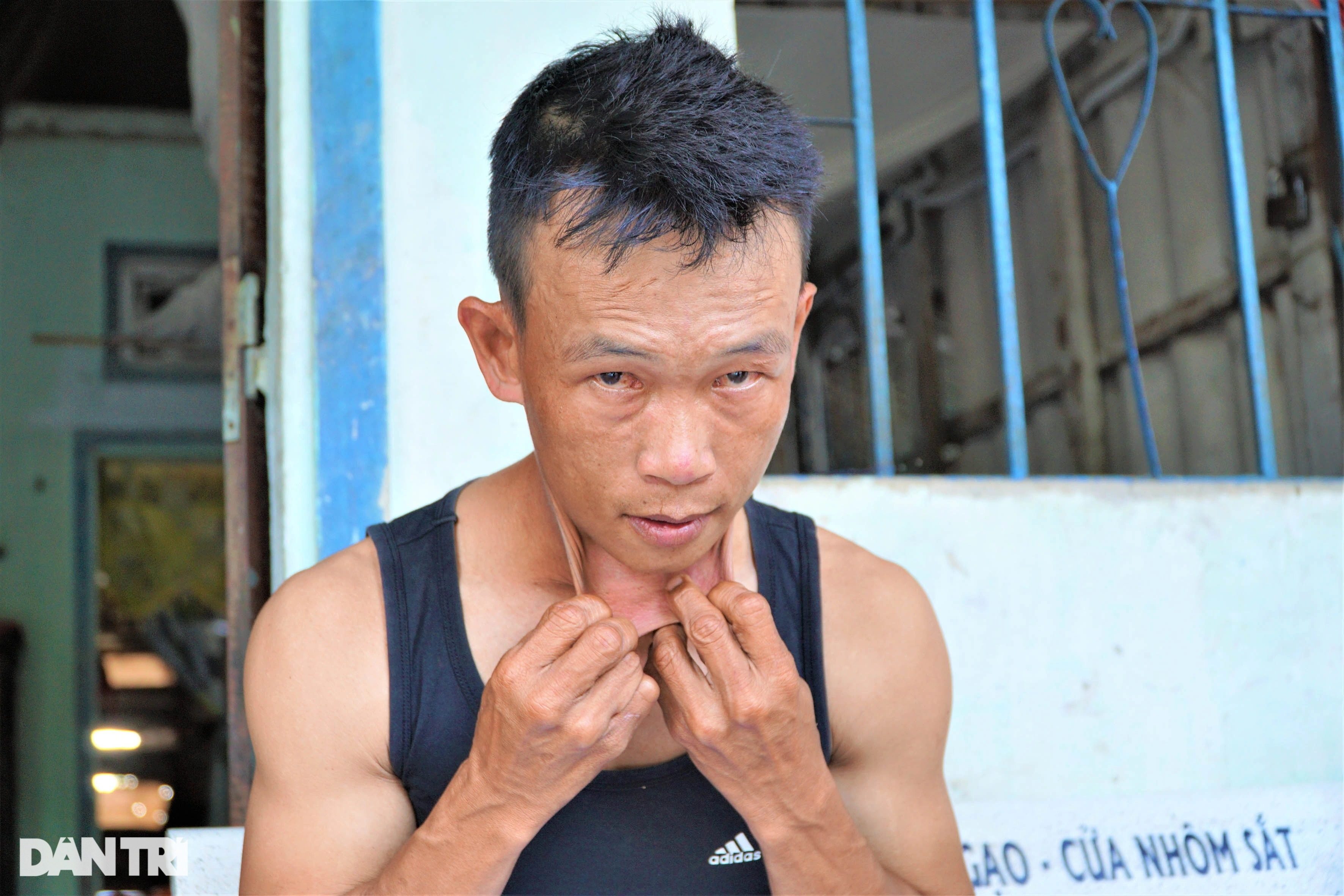 Người đàn ông miền Tây có làn da kéo giãn như cao su tay chân bẻ gập 180 độ - 2 Người đàn ông miền Tây có làn da kéo giãn như cao su tay chân bẻ gập 180 độ - 2