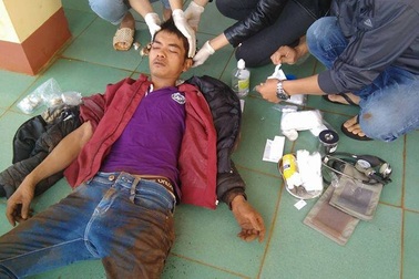 Cả làng vây bắt đối tượng trộm 5 con chó