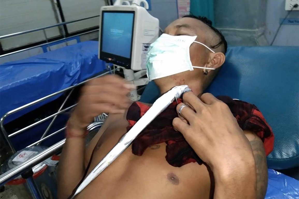 Cá nhái mỏ nhọn đâm thủng cổ du khách tắm biển - 1 Cá nhái mỏ nhọn đâm thủng cổ du khách tắm biển - 1