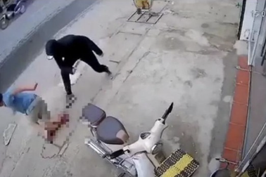 Truy tố một đối tượng trong vụ chém đứt lìa chân người đàn ông ở Hà Nội