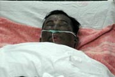 Bị vợ tạt axít khi đang ngủ