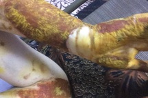 Nữ sinh bị bỏng ở phòng thực hành: “Không muốn bạn học bị đình chỉ hay hạ hạnh kiểm”