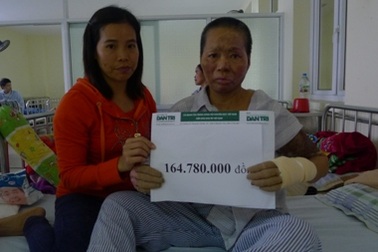 Hơn 200 triệu đến với hai gia đình bị bỏng tại Viện bỏng quốc gia